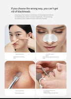 Electric Blackhead Remover Cleaner Face Diamond Pore Vacuum Suction