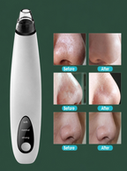 Electric Blackhead Remover Cleaner Face Diamond Pore Vacuum Suction
