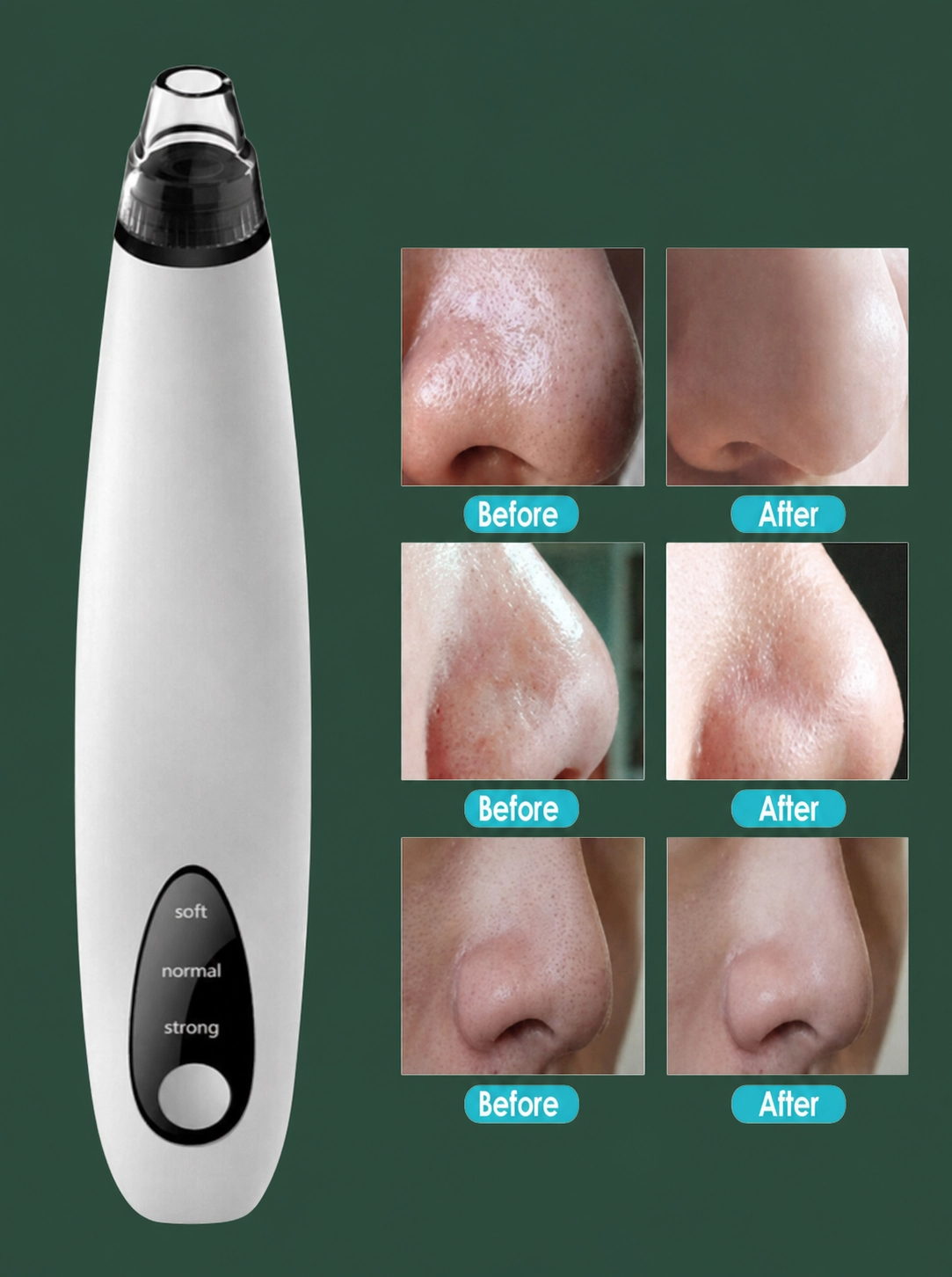 Electric Blackhead Remover Cleaner Face Diamond Pore Vacuum Suction